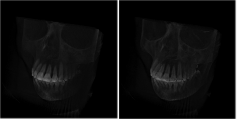 Skull_Basic_Silhouette