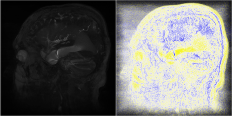 Ventricles_Basic_Tonemapped.png